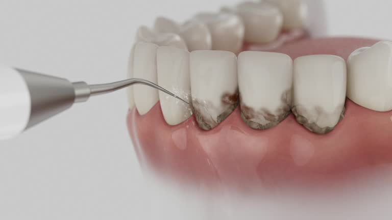 Reliable Wisdom Tooth Removal contractor in Houston County County, AL by Dentist Open Now